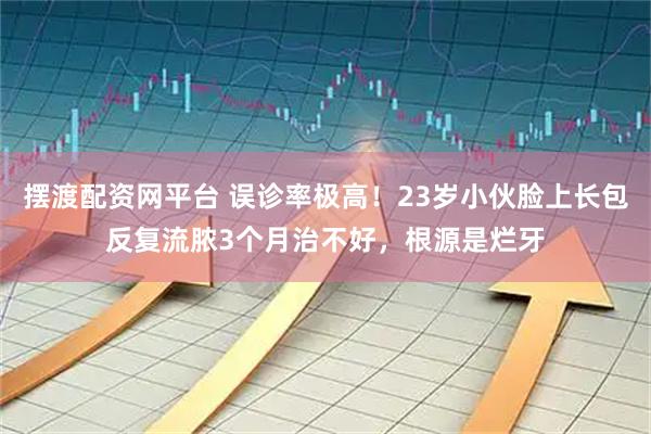 摆渡配资网平台 误诊率极高!23岁小伙脸上长包反复流脓3个月治不好,根源是烂牙